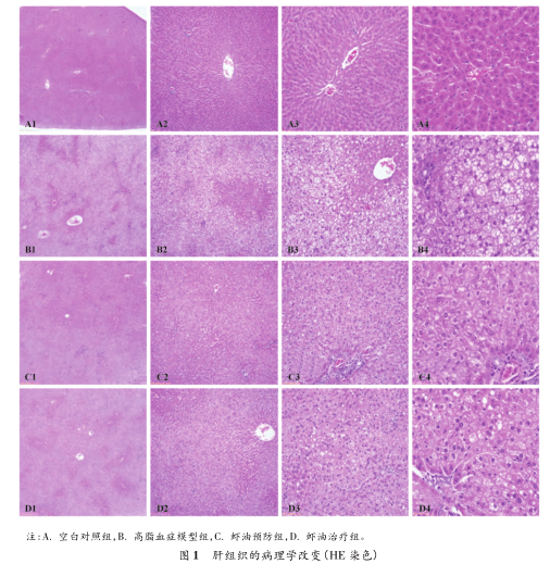 Literature Review - Comparison of the Adjunctive Preventive and Therapeutic Lipid-lowing Effects of Antarctic Krill Oil on Rat Models of Hyperlipidemia